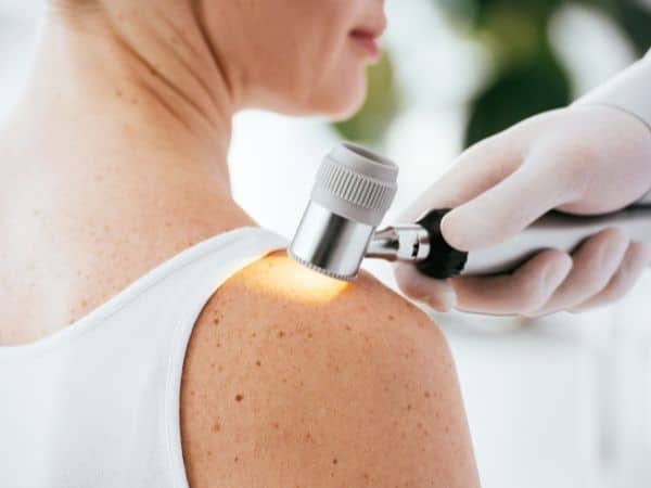 specialista di dermatologia a domicilio esamina la pelle su una spalla di una paziente